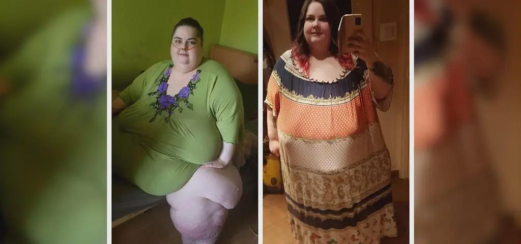 Ważyła 300 kilogramów, teraz schudła i pierwszy raz od 5 lat sama wyszła z domu
