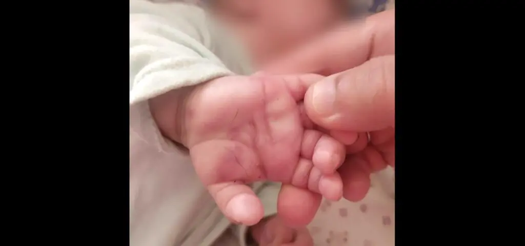 5-miesięczny chłopiec ze złamaną ręką i nogą. "To niewyobrażalne"