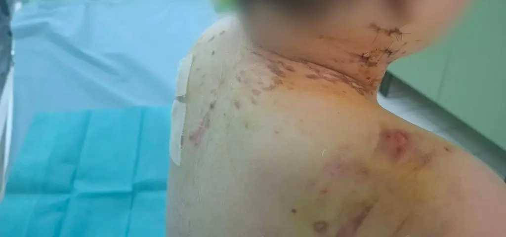 Psy zaatakowały 9-latka i wciągnęły z drogi na posesję. „One dalej będą stwarzały zagrożenie”