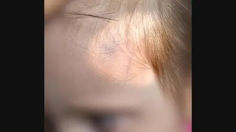 Co działo się w przedszkolu?