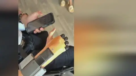 Nowa ręka Dominika. Jak radzi sobie nastolatek?