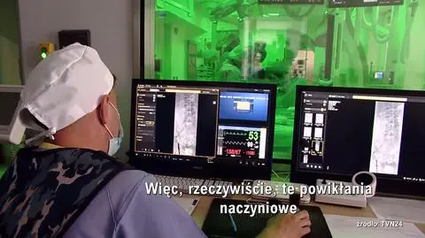 Powikłania po COVID-19. Pacjent miał rozwarstwioną aortę po COVID-19