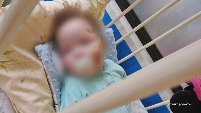 9-miesięczny chłopiec trafił do szpitala ze śladami pobicia